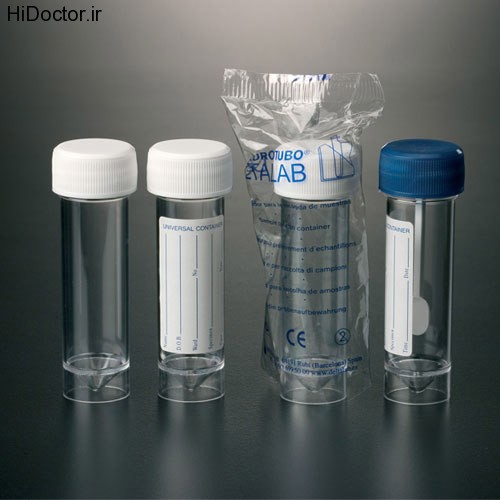 Sterile sample containers (2)