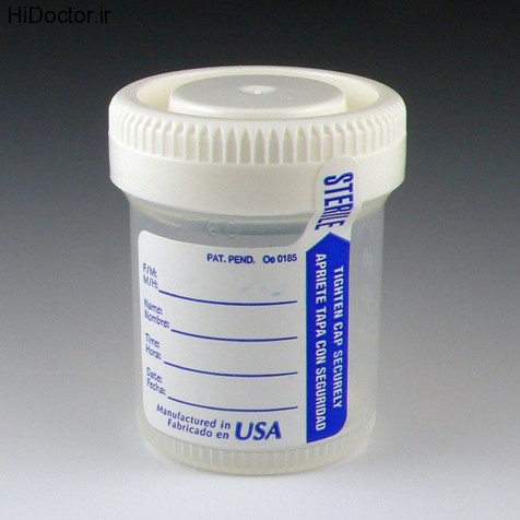 Sterile sample containers (9)