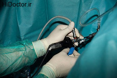 Urological surgery laser (13)