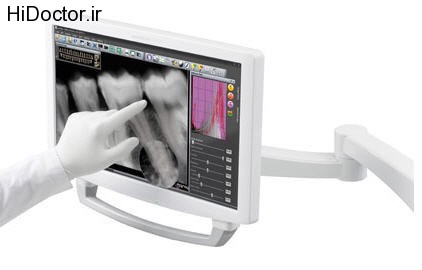 dental monitor (14)
