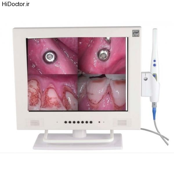 dental monitor (7)