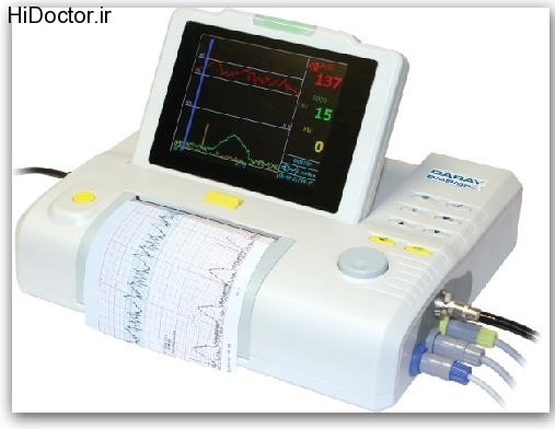 fetal heart monitoring (10)