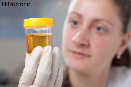 looking-at-urine