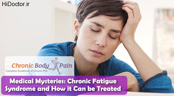 treatment-of-chronic-fatigue-syndrome