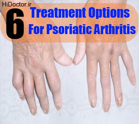 Psoriatic-Arthritis