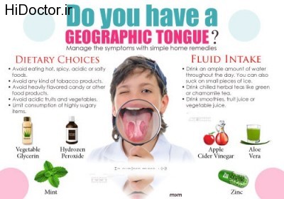 geographic-tongue