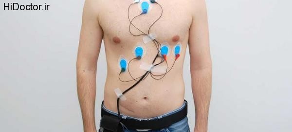 holter monitoring (10)