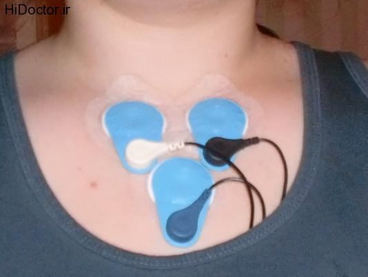 holter monitoring (12)
