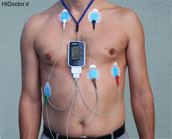 holter monitoring (14)