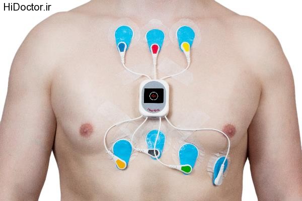 holter monitoring (4)