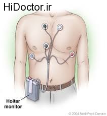 holter monitoring (8)