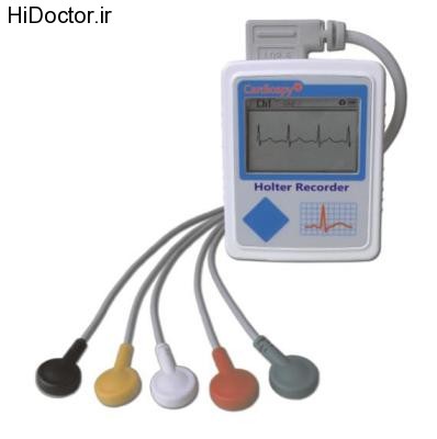holter monitoring (9)