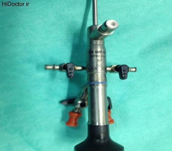 ureteroscope (1)