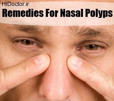 Remedies-For-Nasal-Polyps