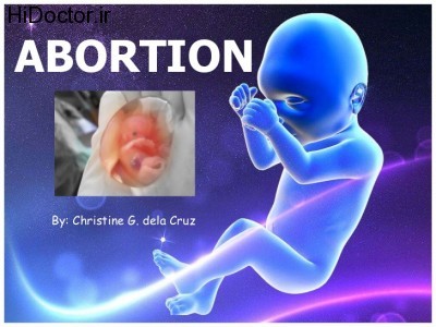 abortion-1-728