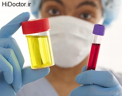 woman-in-scrubs-holding-vial-of-blood-and-urine-sample