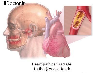 DENTISTRY AND HEART DISEASES PIC 9