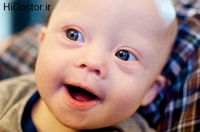 down-syndrome-baby-blue-eyes-syndrom-3
