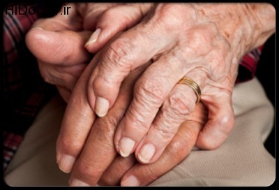 senior-sex-s5-photo-of-senior-hands-with-arthritis