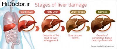 stages-of-liver-damage