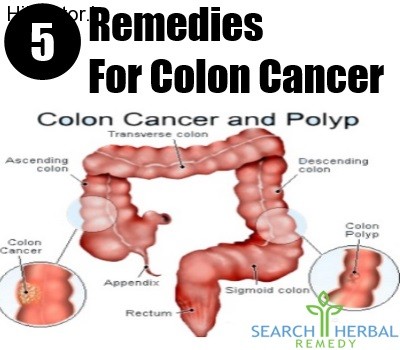 5-Remedies-For-Colon-Cancer-