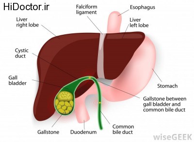 gallstones-in-the-gallbladder