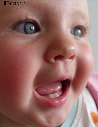 Baby_teeth_in_human_infant
