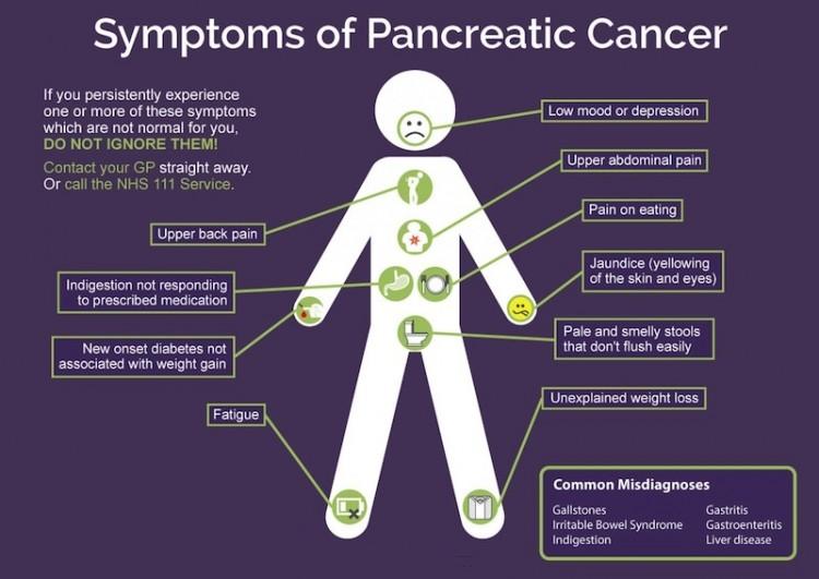 Pancreatic-Cancer-Symptoms
