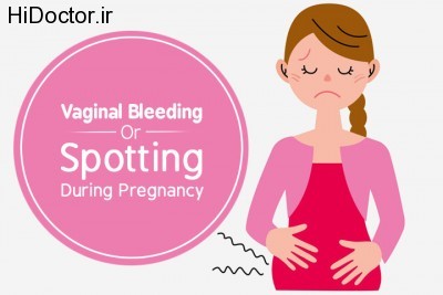 Vaginal-Bleeding-Or-Spotting-During-Pregnancy