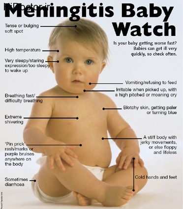 meningitis-baby1