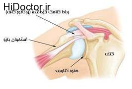 Shoulder joint replacement
