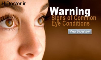 مهمترین هشدارها برای بینایی 1