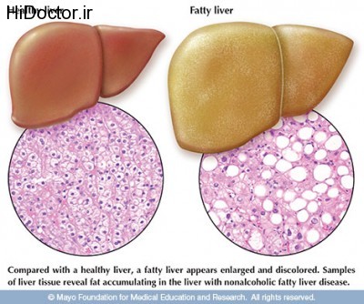 Liver_large