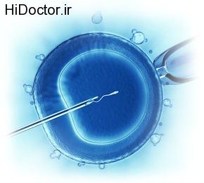 PICSI-Detailed-Sperm-Selection-Technique
