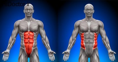 abdominal-muscle-strain