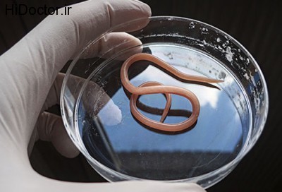 getty_rf_photo_of_roundworm_in_petri_dish