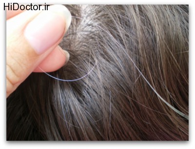 gray-hair-natural-remedies