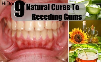 Natural-Cures-To-Receding-Gums
