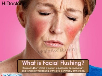 facial-flushing