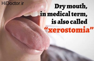 Home-Remedies-for-Dry-Mouth