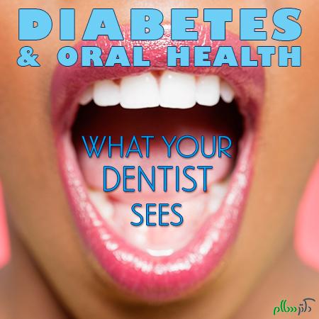 Dental-and-Diabetes