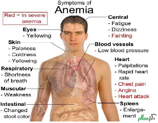 anemia-saidaonline