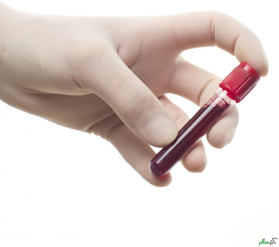 blood-test-for-herpes