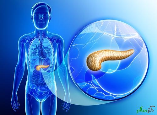 pancreatic-cancer-risks