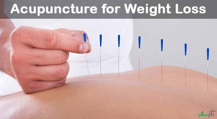 Acupuncture-for-Weight-Loss