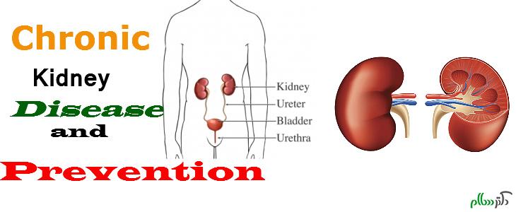 Chronic-Kidney-Disease-Prevention