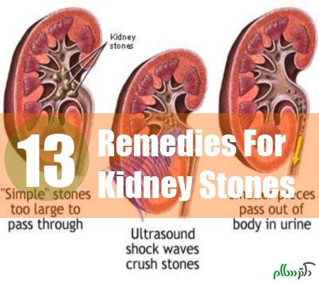 Kidney-Stones1