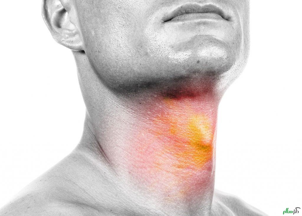 انواع نشانه های خطرناک در سر و گردن . 1