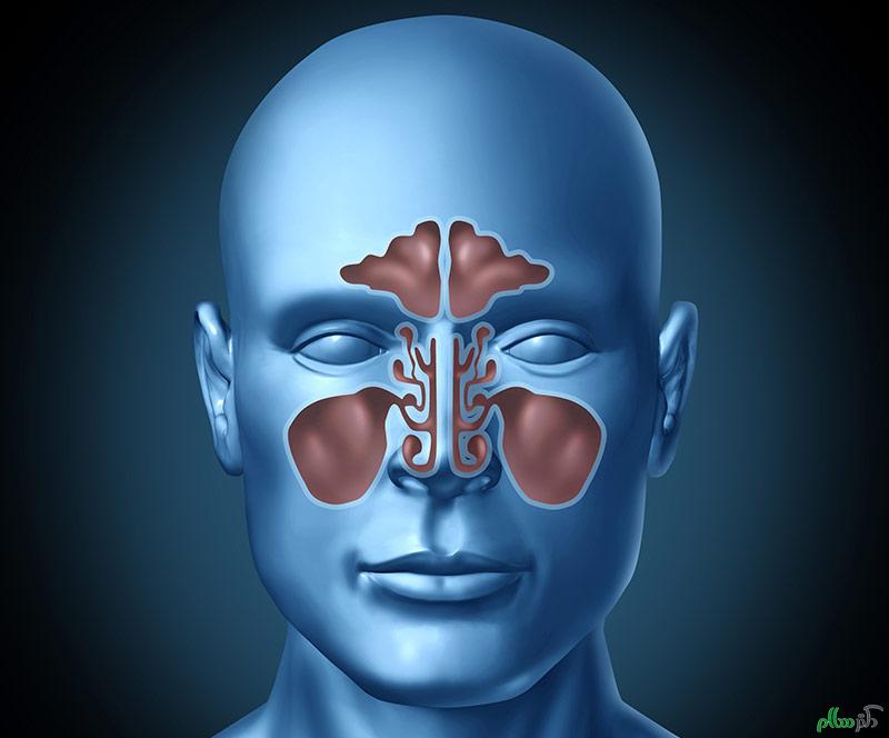 راه های مختلف برای درمان سینوزیت