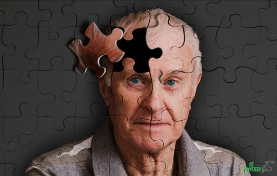 دو راهکار برای پیشگیری از آلزایمر